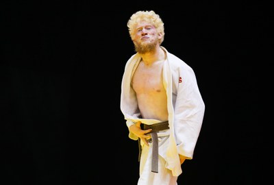 Atletas albinos relatam os desafios de lidar desde cedo com o preconceito