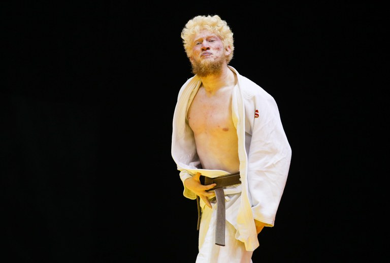 Atletas albinos relatam os desafios de lidar desde cedo com o preconceito Atletas albinos relatam os desafios de lidar desde cedo com o preconceito